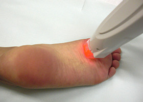 足の裏・指の治療1