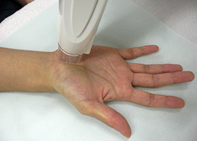 手の平・指の治療1